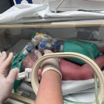 Nacieron en el Hospital Regional Materno Infantil de Guadalupe, Nuevo León unas gemelas siamesas unidas por el ombligo