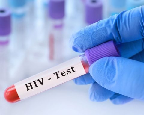 Acuña casos VIH